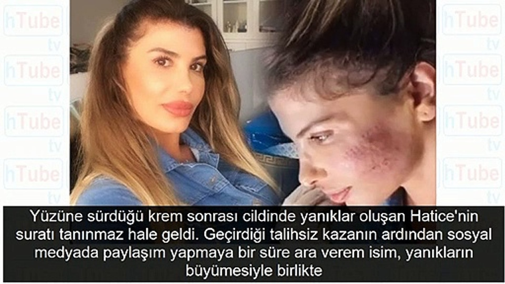 Sarkici Hatice Nin Son Halini Gorenler Tanimakta Gucluk Cekti Video Dailymotion