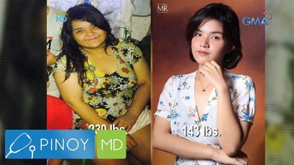 Pinoy MD: Dalagitang nakaranas ng pambu-bully dahil sa timbang, sexy na ngayon!