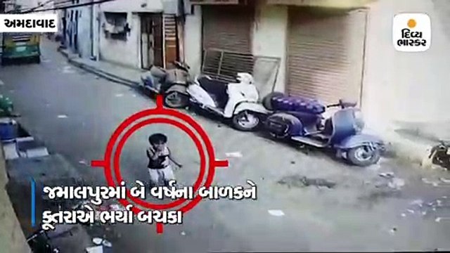 જમાલપુરમાં બે વર્ષના બાળકને કૂતરાએ બચકા ભર્યા, હોસ્પિટલમાં ખસેડવામાં આવ્યો