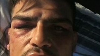 Kelvin Gastelum gives an update on his health and condition after the 5 round war he had with Israel Adesanya at UFC 236.