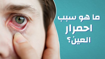 ما هو سبب احمرار العين؟