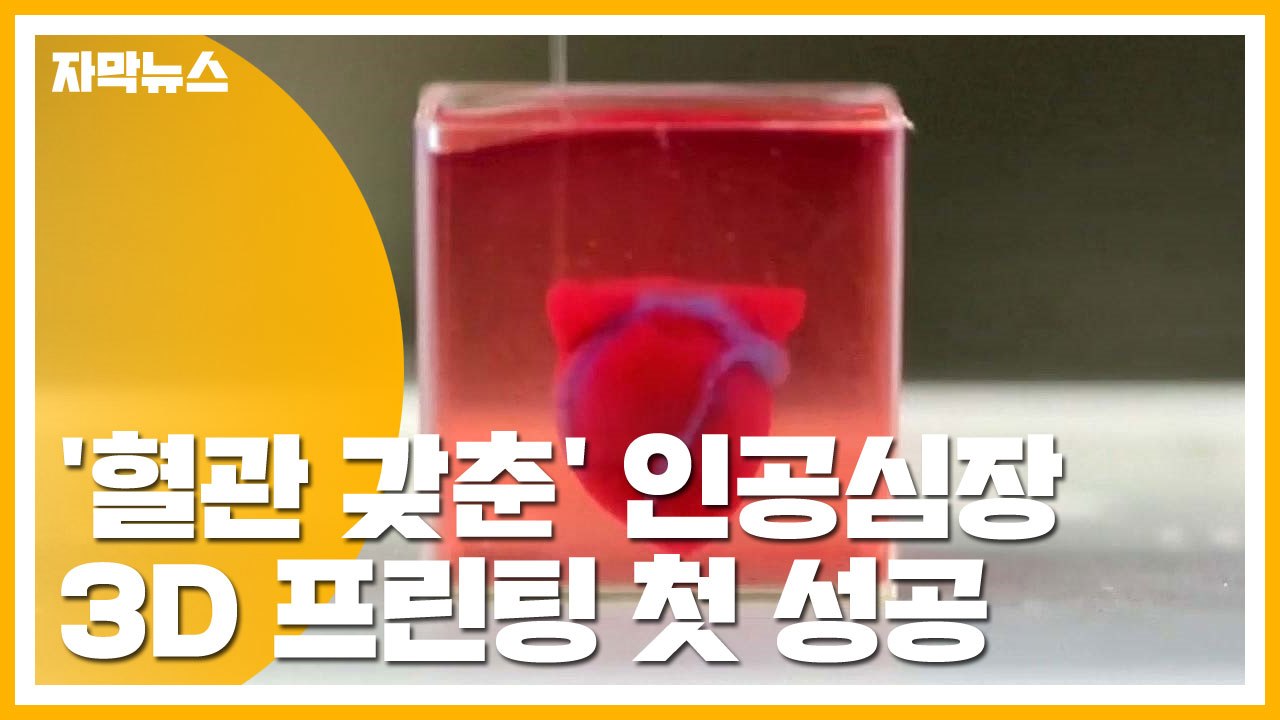 [자막뉴스] '혈관 갖춘' 인공심장 3D 프린팅 첫 성공 / YTN