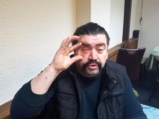 Asker Uğurlamasında Terör Estiren Şahıslar Tartıştıkları Adamın Gözünü Çıkardı