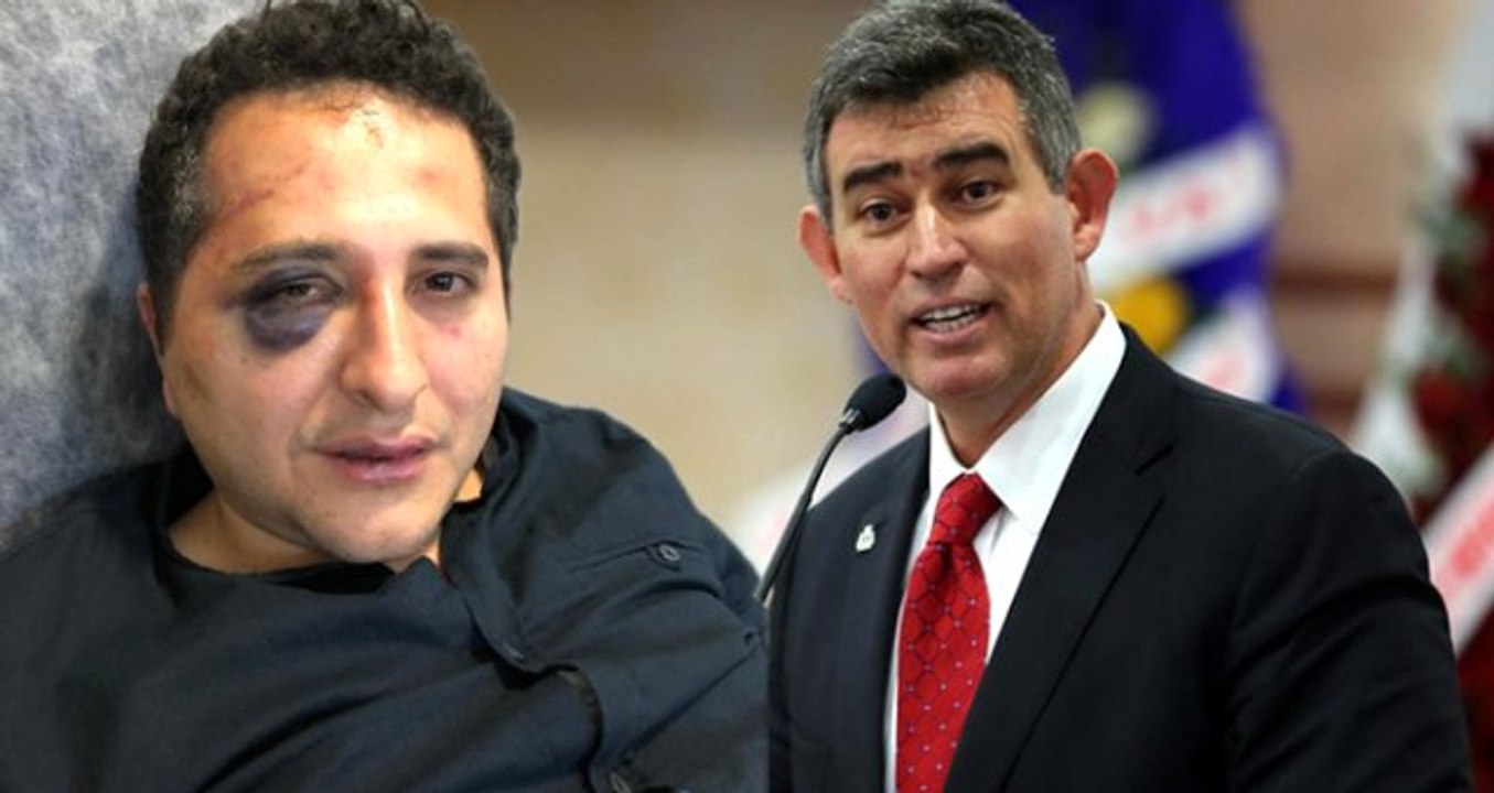 "Erdoğan Korumalarından Avukata Dayak" İddiasına Feyzioğlu'ndan Tepki: Fotoğrafa İyi Bakın, 3-5 Kabadayı Bunu Yaptı