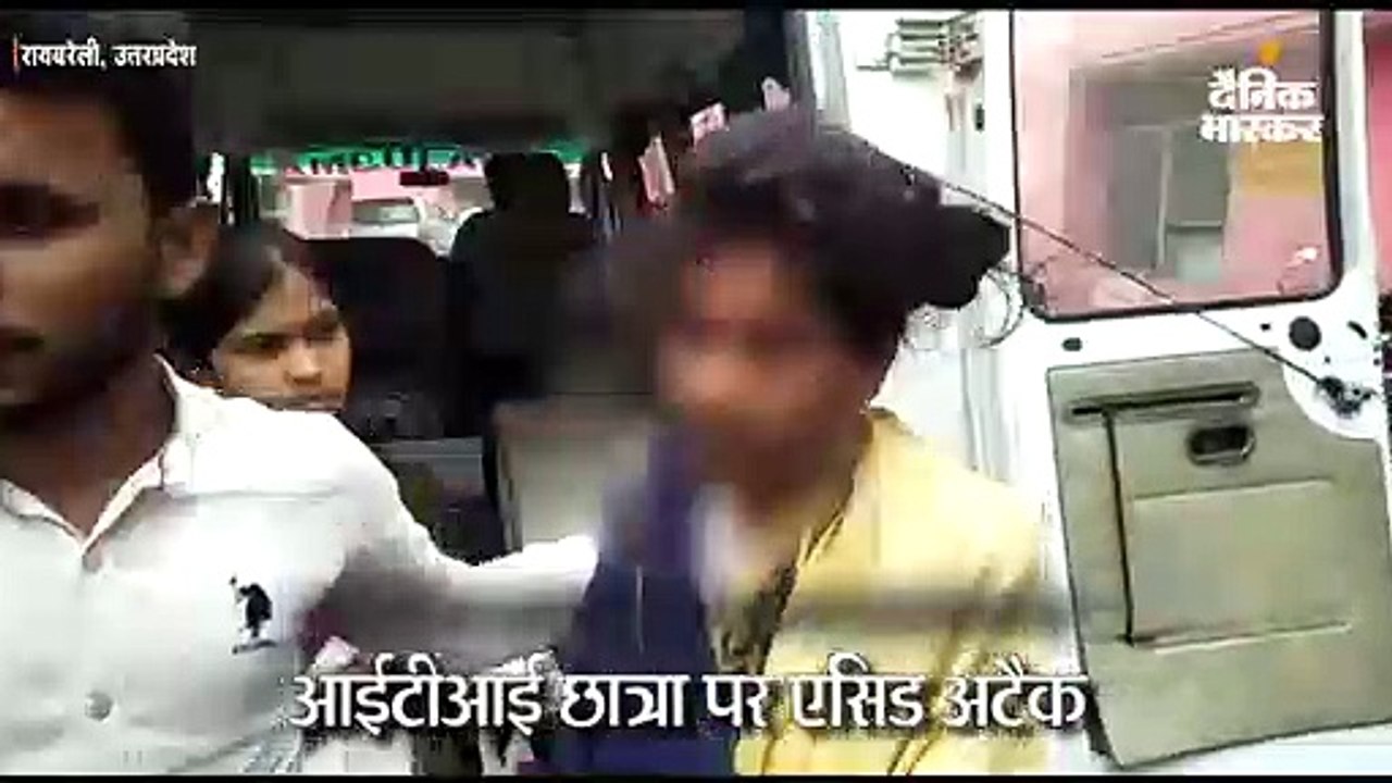 आईटीआई छात्रा पर एसिड अटैक, लोगों के दौड़ने पर फरार हुए बाइक सवार आरोपी