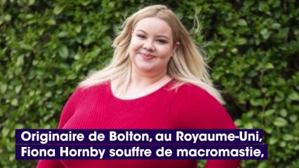 Royaume-Uni : cette jeune femme souffre de macromastie, sa poitrine ne cesse d’augmenter !