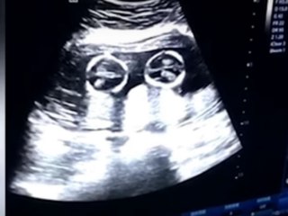 இப்படி ஒரு சண்டையை பாத்திருக்கிங்களா மக்களே !