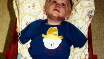 Child Born With Mermaid Syndrome And Given Weeks To Live | Miracle Babies | Eglantine Egla