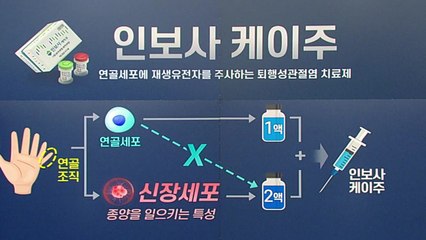[뉴스TMI] 알고 보니 다른 성분? 인보사 사태...진짜 성분과 쟁점 / YTN