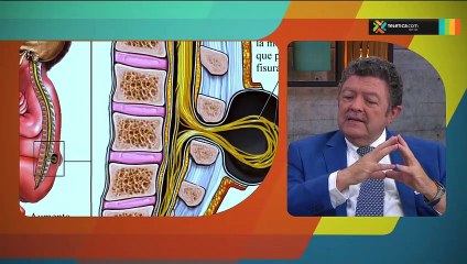 bd-espina-bifida-oculta-170419