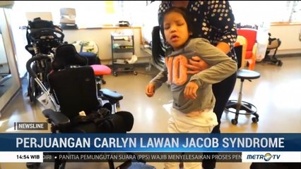 Perjuangan Carlyn Lawan Jacob Syndrome