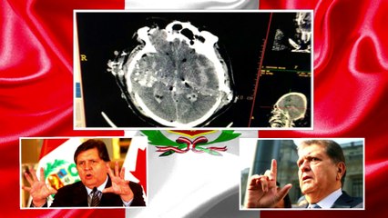Fallece Alan García expresidente de Perú tras darse un tiro en la cabeza