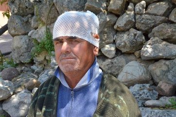 Yağmurdan Korunmak İçin Girdikleri Oyukta Üzerlerine Yıldırım Düştü