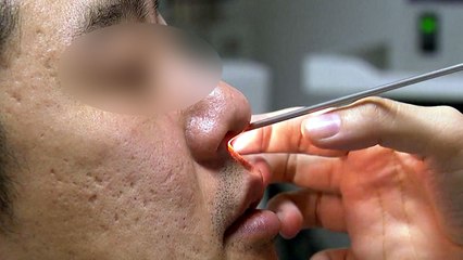 봄철 비염 환자 늘어...9세 이하 어린이 환자가 특히 많아 / YTN