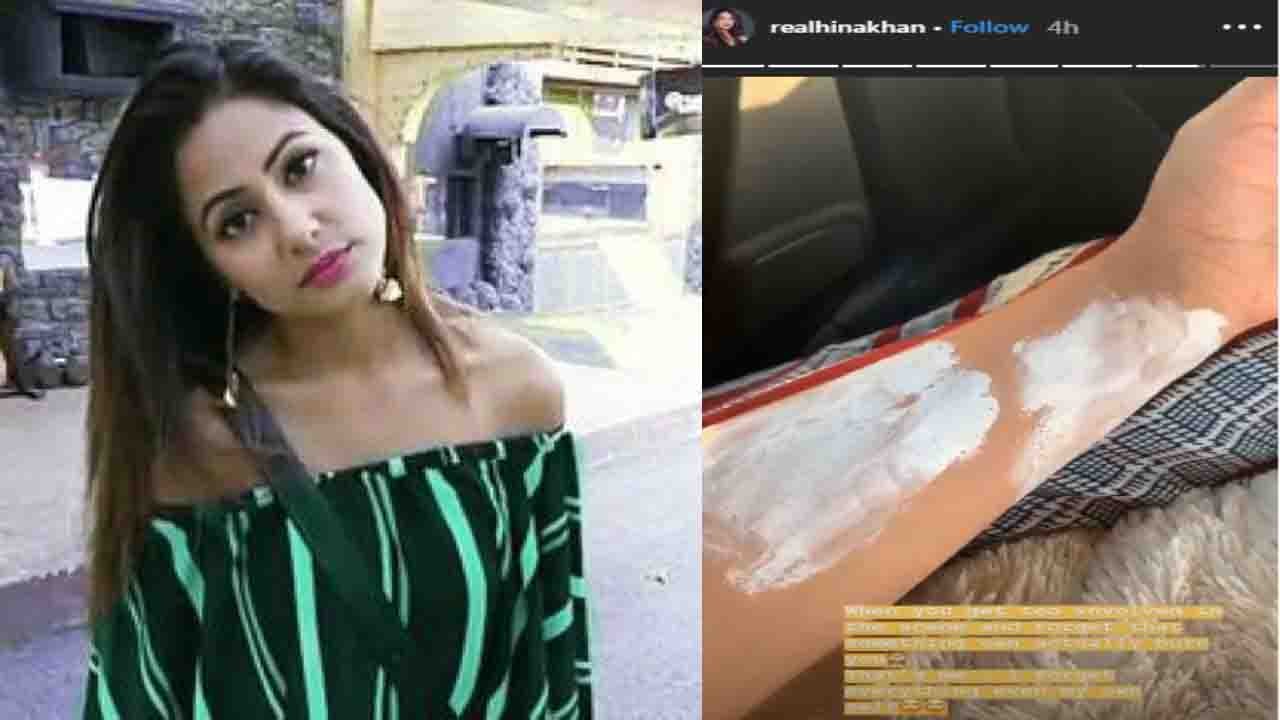 Hina Khan burns injuries during shooting for a scene of Kasautii Zindagii Kay | FilmiBeat