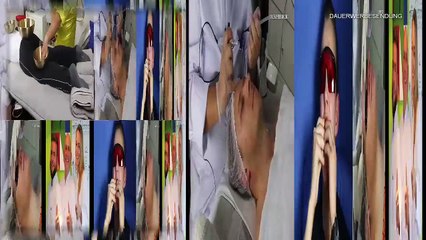 Dauerhafte Haarentfernung und es geht doch! Achselhaare beim Mann