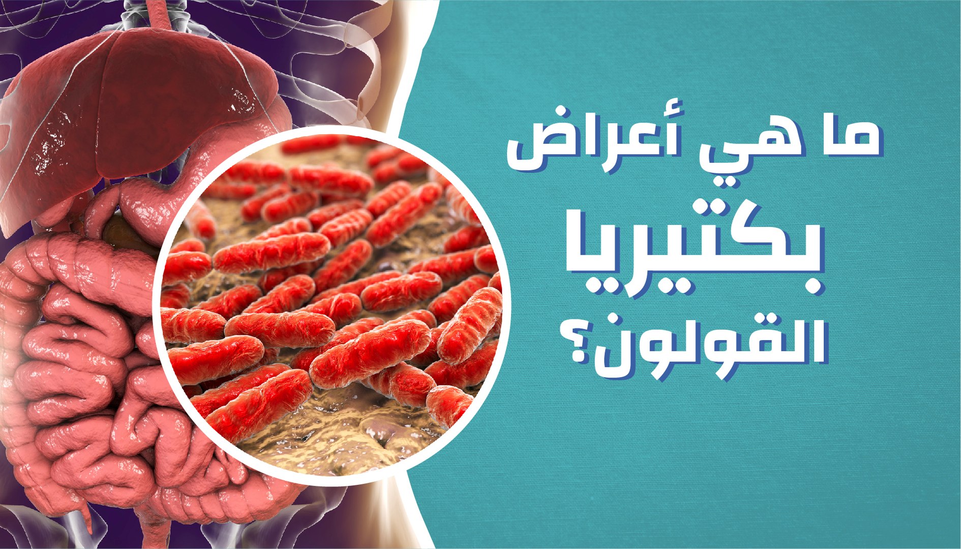 ما هي أعراض بكتيريا القولون فيديو Dailymotion