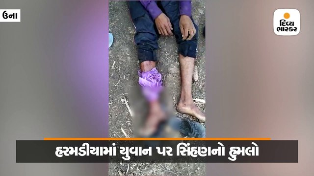 ઉનાના હરમડીયા ગામે વાડીમાં રહેતા યુવાન પર સિંહણનો હુમલો, પગમાં ઇજા કરી