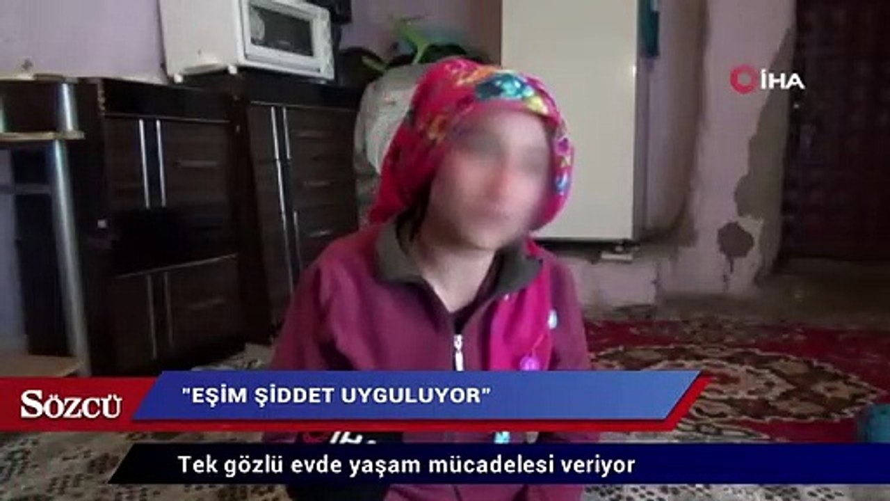Tek gözlü evde yaşam mücadelesi veriyor