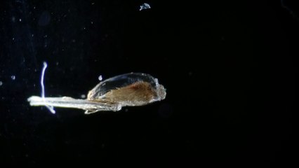 Head Lice Eggs and Unknown Creature in Hair (GROSS!)