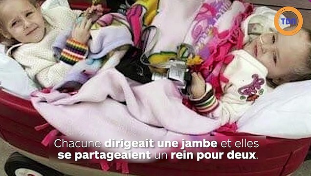 Ces sœurs siamoises vivent (presque) comme toutes les ados depuis qu'elles sont séparées