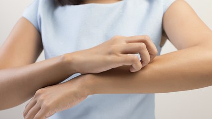 ¿Te pica la piel? Sabemos el porqué
