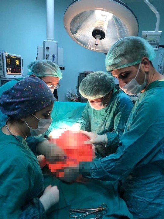 Karın Ağrısıyla Hastaneye Gitti, Karnından 13 Kiloluk Kitle Çıkarıldı