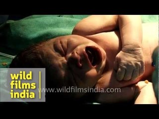Baby's first cry after Caesarean section delivery