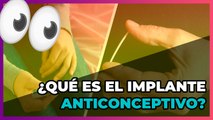 ¿Qué es el Implante anticonceptivo? 