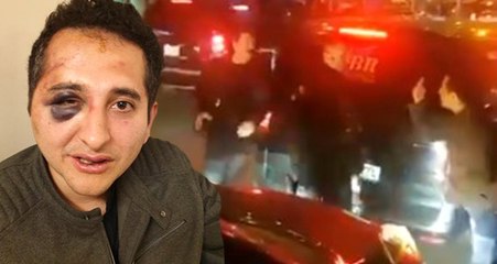 "Erdoğan'ın Korumaları Beni Dövdü" Diyen Avukatın Gözaltına Alınma Görüntüleri Ortaya Çıktı