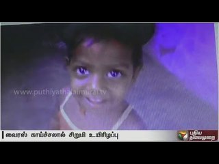 Girl succumbs to viral fever