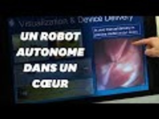 Un robot autonome utilisé pour des opérations du cœur