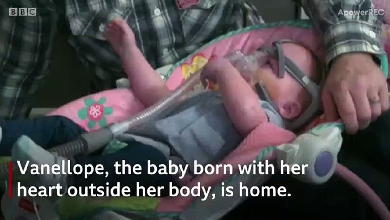 without heart baby in world
