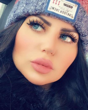 حليمة بولند تعترف لأول مرة بعملية التجميل التي شوهت ملامحها