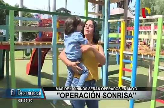 Operación Sonrisa: niños con labio leporino serán operados gratuitamente
