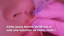 Catastrophe : ses lèvres quadruplent de volume après une injection de botox ratée