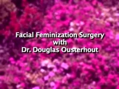 Facial Feminization Surgery - Dr. Douglas Ousterhout