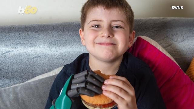 8-Year-Old Boy Celebrates Becoming World's Youngest Person With a Bionic Arm By Eating a Burger With Two Hands!