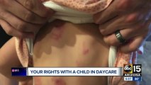 What are parents' rights when something happens at daycare?