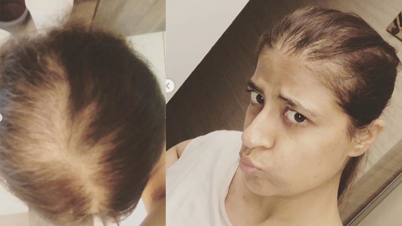 Tahira Kashyap shares her cancer journey with latest post | FilmiBeat