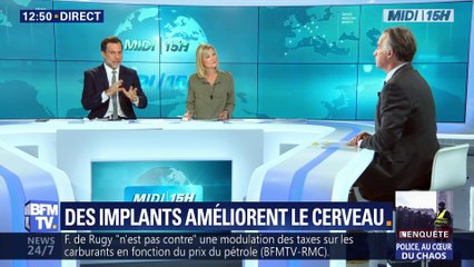Des implants améliorent le cerveau