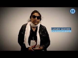 Ataque con ácido: "Que sepan los hombres que hay un castigo por atacar a una mujer"