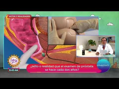 Mitos y realidades: ¿el examen de próstata se hace cada 2 años? | Sale el Sol