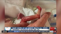 Baby born at 24 weeks beats all odds after a different technique saved her life