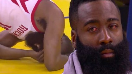 James Harden Leaves Game BLEEDING From Eye, Comes Back & Gets ROASTED By Twitter