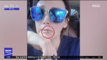 [투데이 연예톡톡] 이상아, 입술 필러 '성형 부작용' 고백