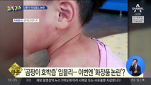 [핫플]“임블리 선스틱 사용 후 피부 뒤집어졌다” 논란