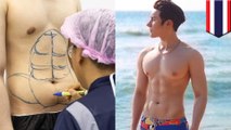 Operasi plastik sekarang bisa buat perut six pack,  - TomoNews