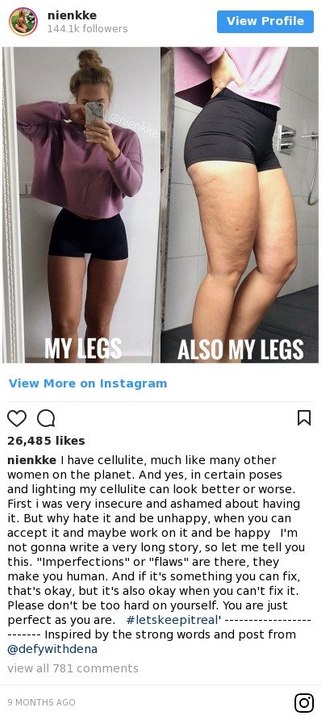 Nienke, eine niederländische Influencerin, die ihre Cellulite ohne Komplexe zeigt