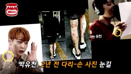 박유천, 거짓과 현실 구분 못하는 리플리 증후군.. 다리 상처 진실 밝혀지나